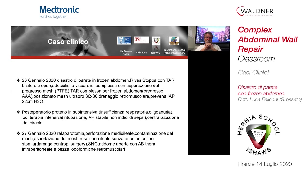 Disastro di parete con frozen abdomen General Surgery Update